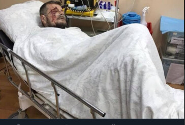 Мосийчук мог оказаться случайной жертвой: бомба ждала другого политика
