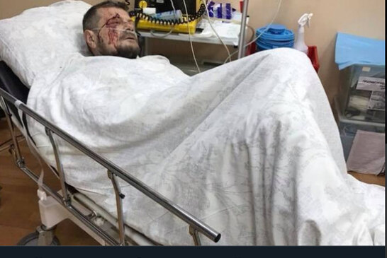 Мосийчук мог оказаться случайной жертвой: бомба ждала другого политика