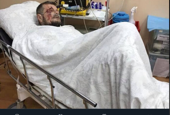Мосийчук мог оказаться случайной жертвой: бомба ждала другого политика