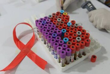 России нужна федеральная программа по профилактике ВИЧ, считает эксперт
