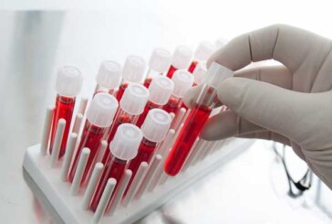 Пьяных водителей определят по анализу крови