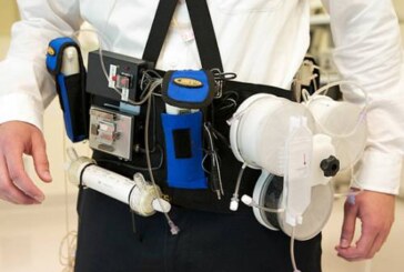 Гемодиализ в рюкзаке: ученые изобрели новые варианты искусственной почки