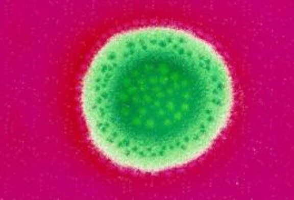Лихорадка Ласса: смертельное заболевание, от которого нет вакцины