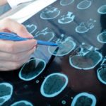 Ученые разработали татуировку, способную выявить рак на ранних стадиях