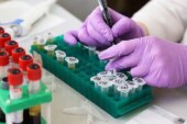 Папилломавирус, Helicobacter и кошачья двуустка: инфекции, причастные к развитию рака