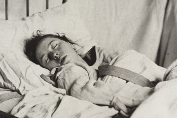 Психические расстройства увеличивают риск хронических заболеваний