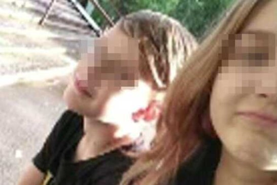 Забеременевшую от 10-летнего мальчика школьницу положили в больницу